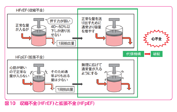 図10収縮不全と拡張不全の説明イラスト
